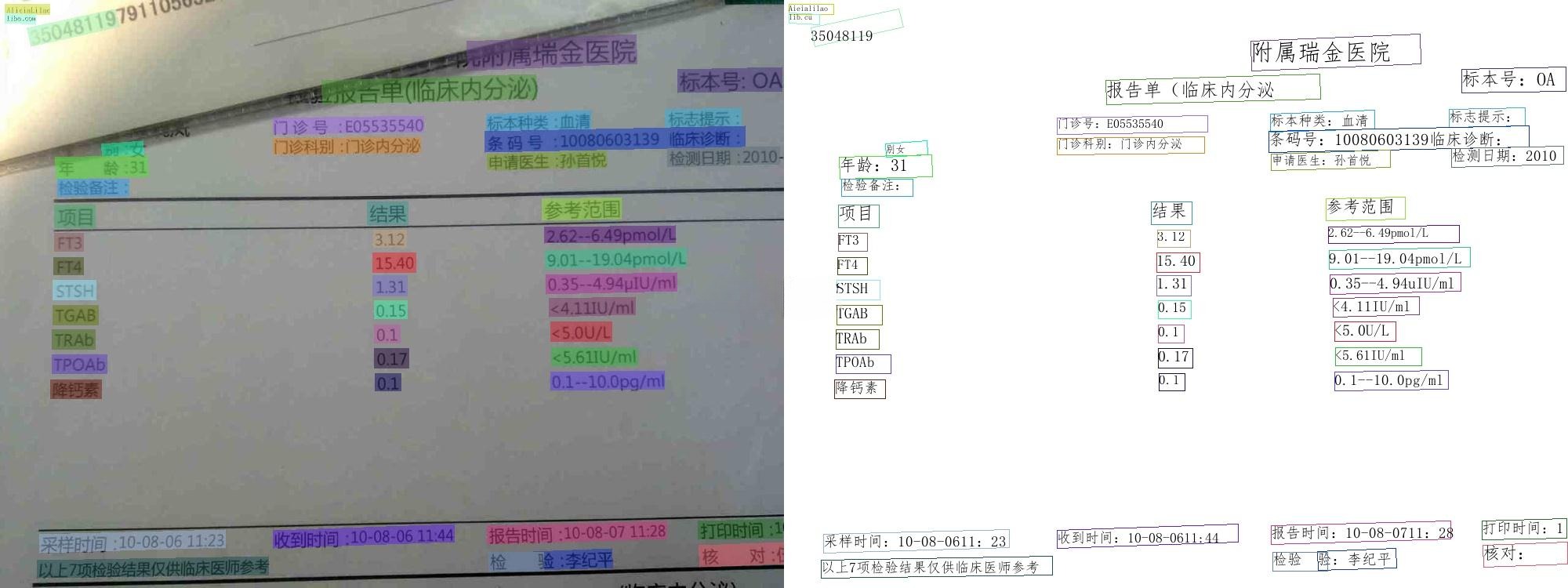 PaddleOCR 2025智能文字识别系统源码 图片 PaddleOCR 2025智能文字识别系统源码 图片